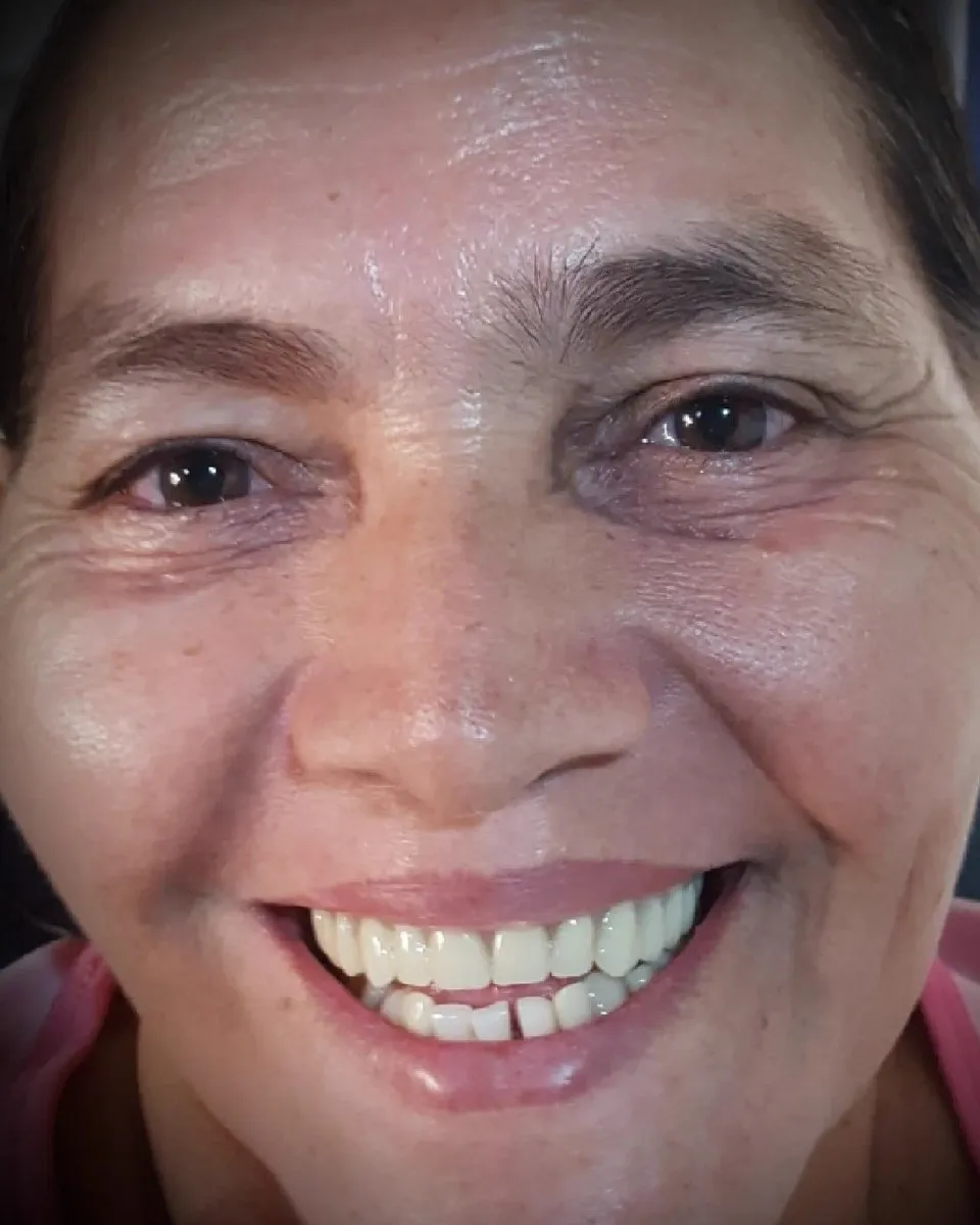 Cándida