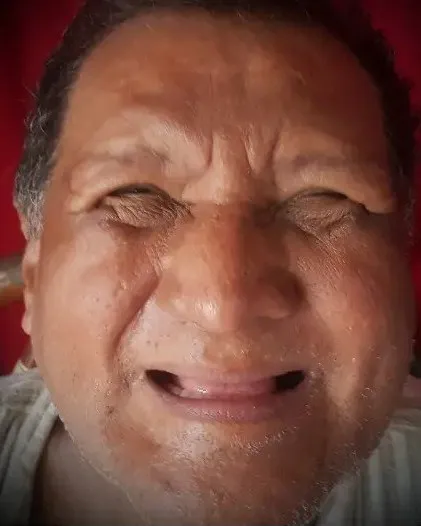 Chepito