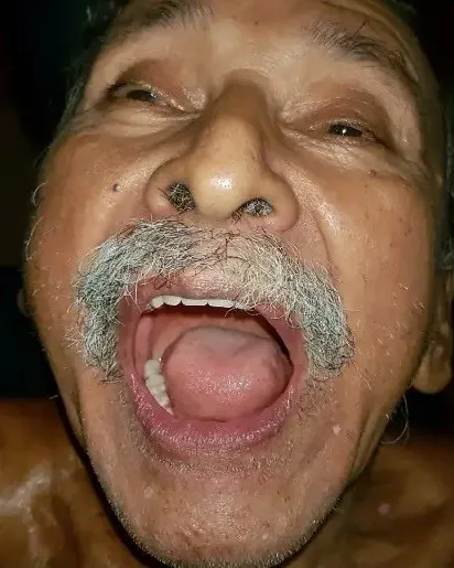 Raúl