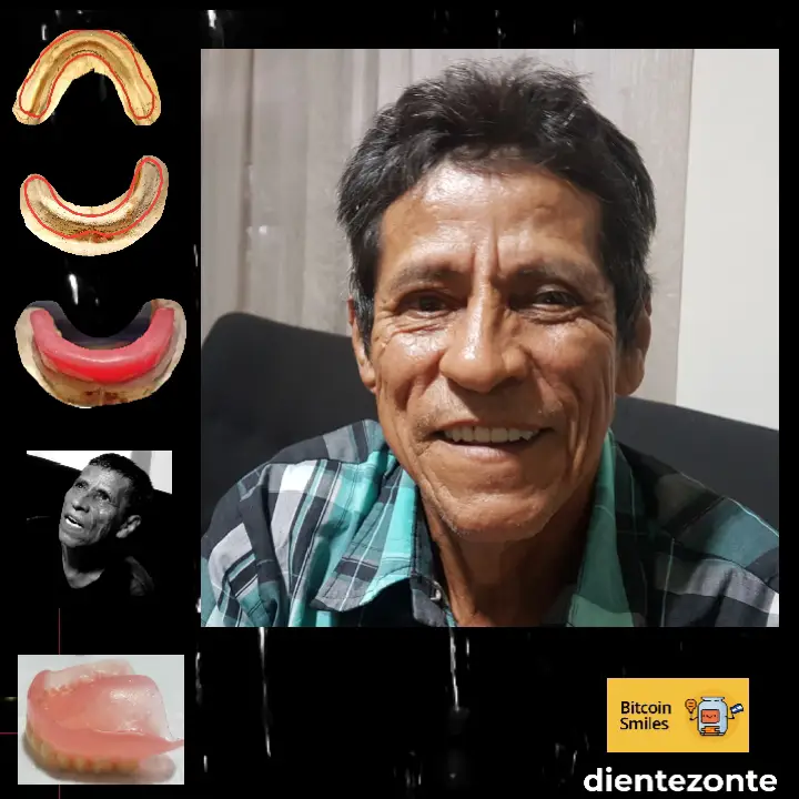 Historia de Bitcoin Smiles: Adrián. Lee su historia en Bitcoin Smiles y ayúdanos a recaudar más fondos para la atención dental gratuita