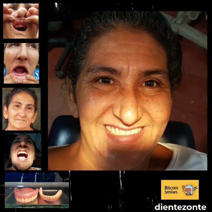 Historia de Bitcoin Smiles: Antonia. Lee su historia en Bitcoin Smiles y ayúdanos a recaudar más fondos para la atención dental gratuita