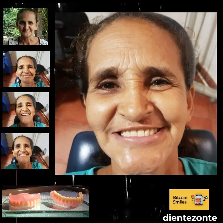 Insert variable
Bitcoin Smiles Story: Arcely. Read her story on Bitcoin Smiles and help us to raise more funds for free dental care
