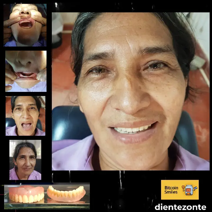 Bitcoin Smiles Story: Maria. Read her story on Bitcoin Smiles and help us to raise more funds for free dental care