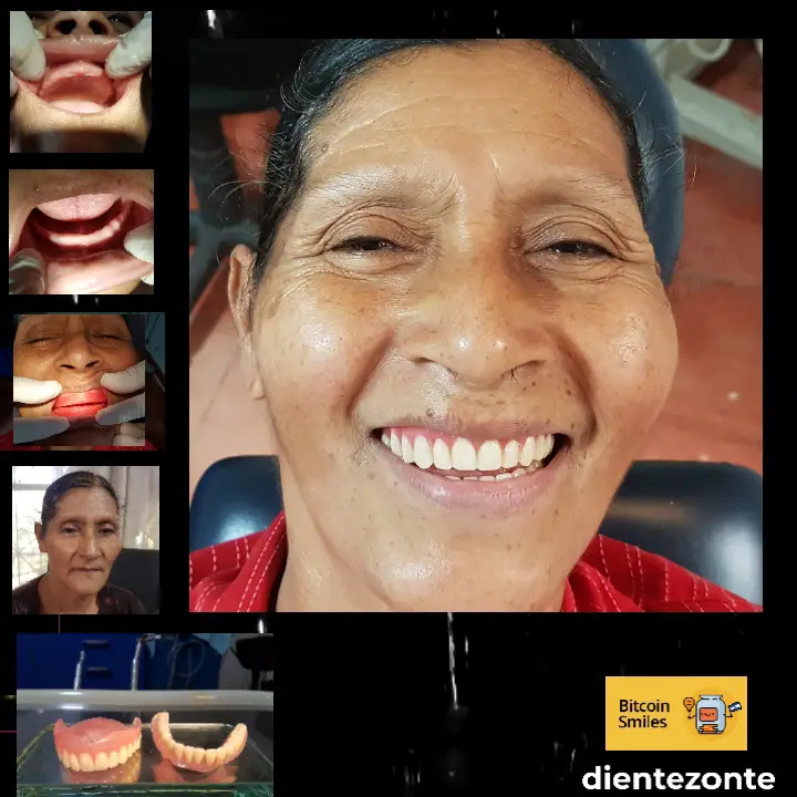 Bitcoin Smiles Story: Margarita. Read her story on Bitcoin Smiles and help us to raise more funds for free dental care