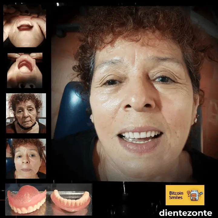 Bitcoin Smiles Story: Maria. Read her story on Bitcoin Smiles and help us to raise more funds for free dental care