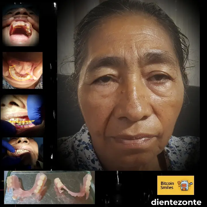 Bitcoin Smiles Story: María Isabel. Read her story on Bitcoin Smiles and help us to raise more funds for free dental care