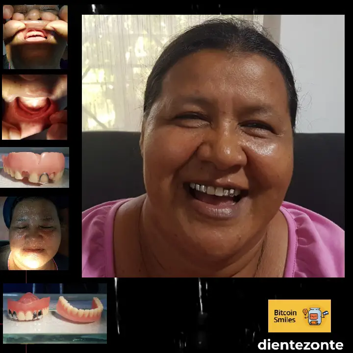 Bitcoin Smiles Story: María. Read her story on Bitcoin Smiles and help us to raise more funds for free dental care