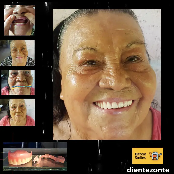 La historia de Bitcoin Smiles: Maura. Lee su historia en Bitcoin Smiles y ayúdanos a recaudar más fondos para la atención dental gratuita