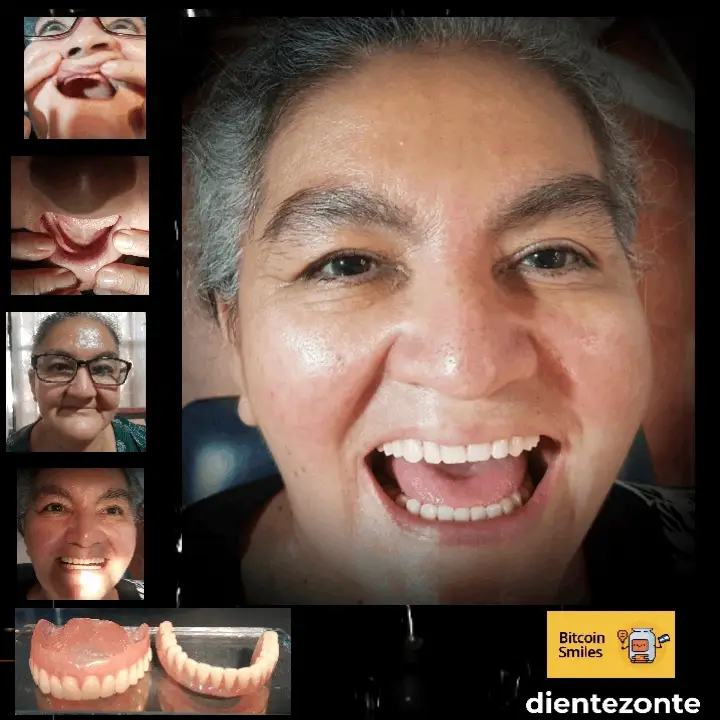 Bitcoin Smiles Story: Reyna. Read her story on Bitcoin Smiles and help us to raise more funds for free dental care
