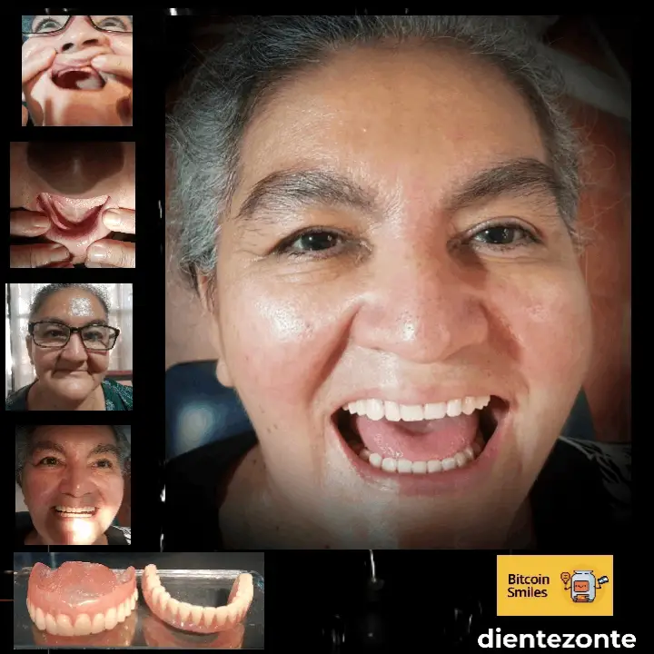 Historia de Bitcoin Smiles: Reyna. Lee su historia en Bitcoin Smiles y ayúdanos a recaudar más fondos para la atención dental gratuita