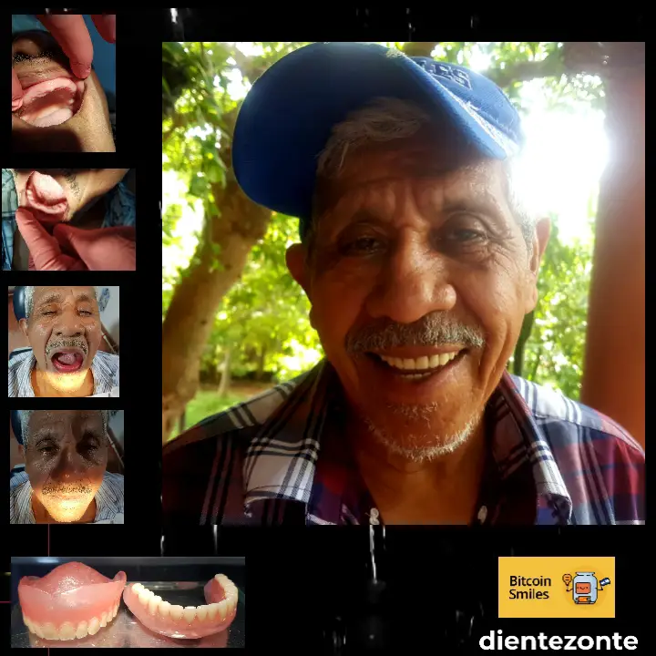 Historia de Bitcoin Smiles: Víctor. Lee su historia en Bitcoin Smiles y ayúdanos a recaudar más fondos para la atención dental gratuita
