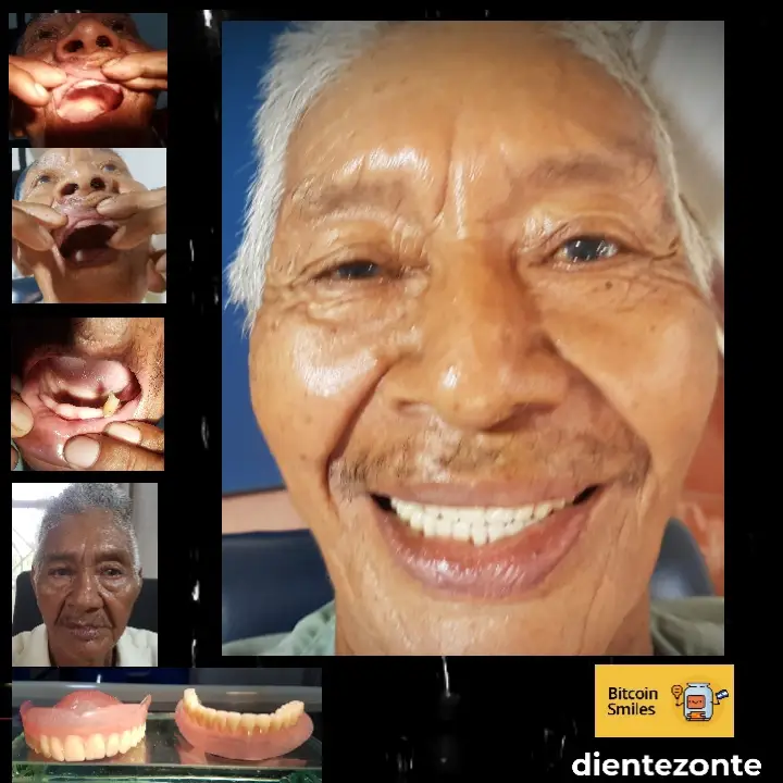Bitcoin Smiles Story: Alberto. Read his story on Bitcoin Smiles and help us to raise more funds for free dental care