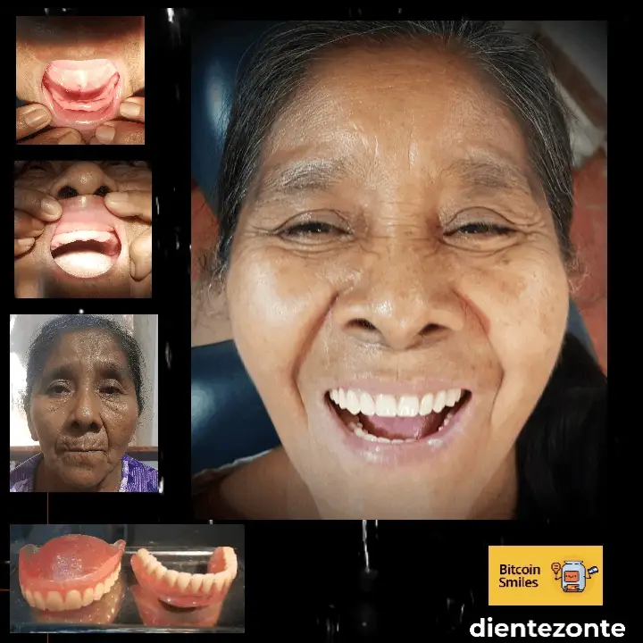 Bitcoin Smiles Story: Guillerma. Read her story on Bitcoin Smiles and help us to raise more funds for free dental care