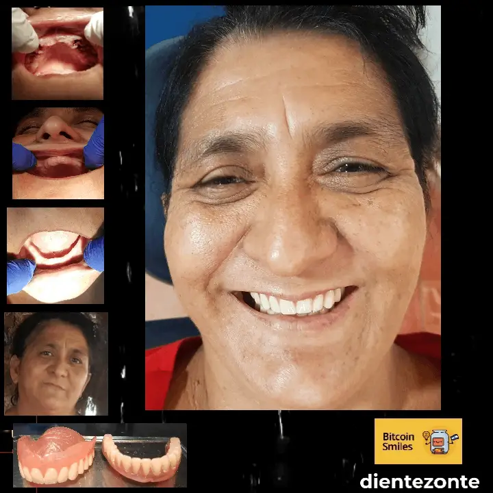 Bitcoin Smiles Story: Marcelina. Read her story on Bitcoin Smiles and help us to raise more funds for free dental care