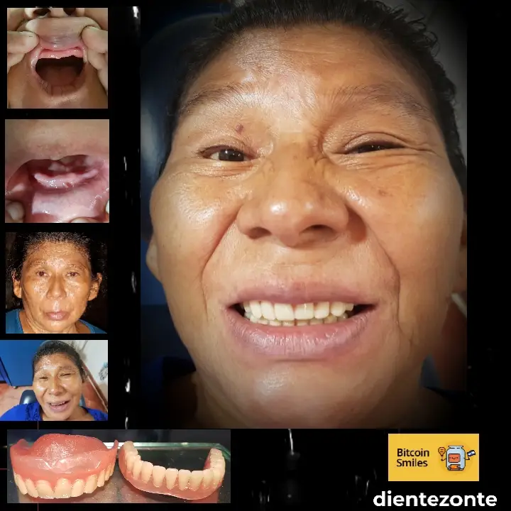 Bitcoin Smiles Story: Mercedes. Read her story on Bitcoin Smiles and help us to raise more funds for free dental care