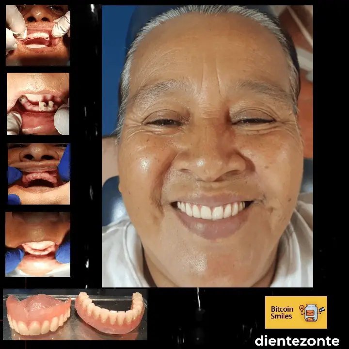 Bitcoin Smiles Story: Rosa. Read her story on Bitcoin Smiles and help us to raise more funds for free dental care