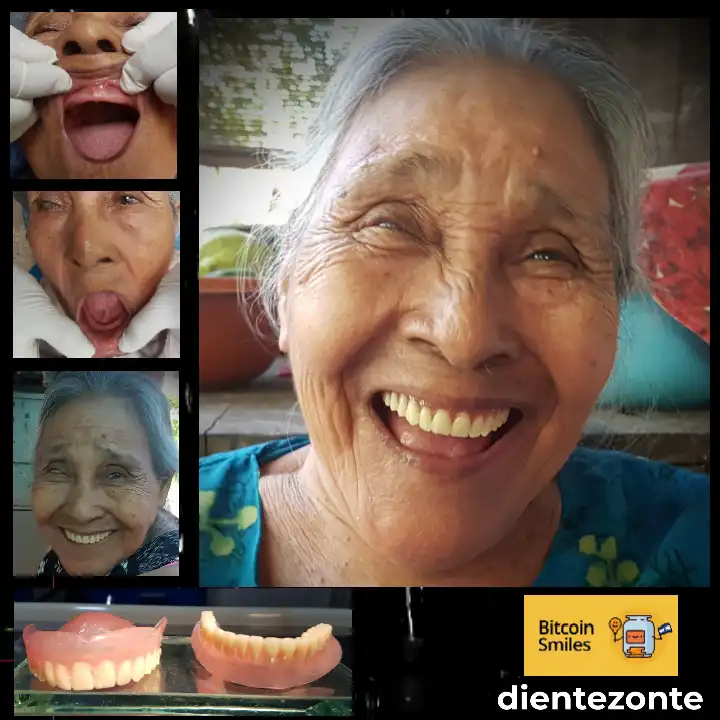 Historia de Bitcoin Smiles: Antonia. Lee su historia en Bitcoin Smiles y ayúdanos a recaudar más fondos para la atención dental gratuita