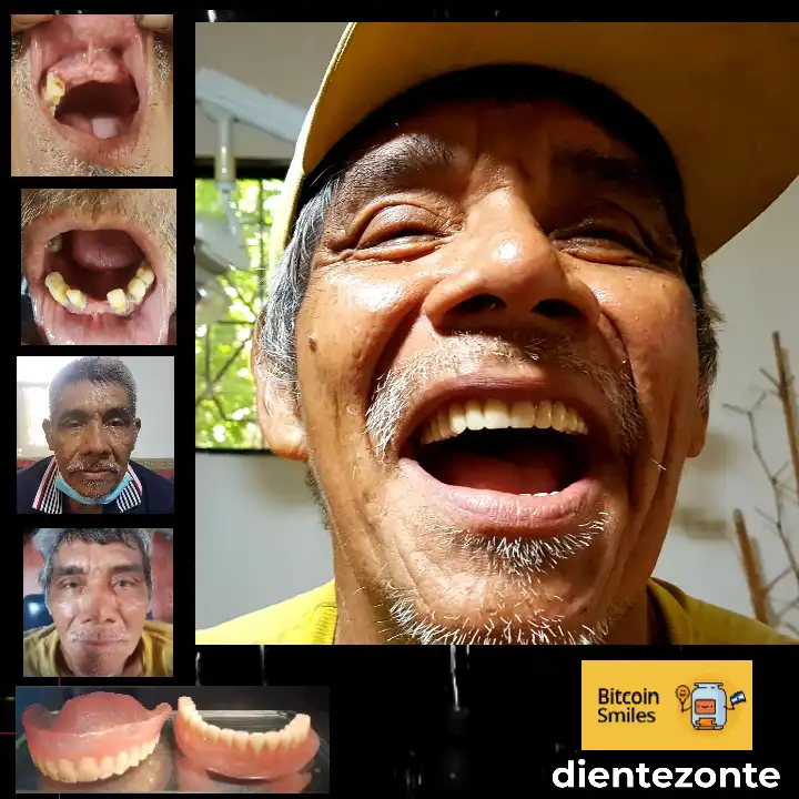 Bitcoin Smiles Story: Williams. Read his story on Bitcoin Smiles and help us to raise more funds for free dental care