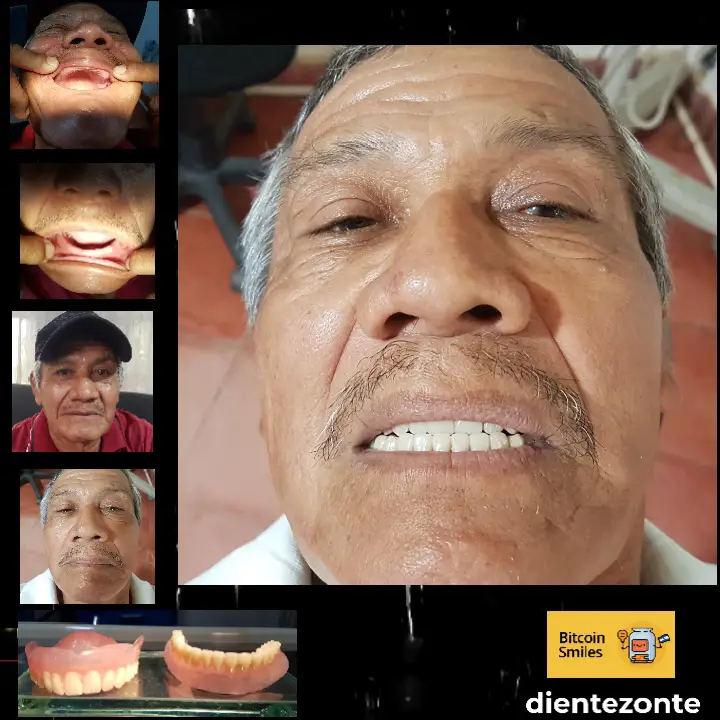 Bitcoin Smiles Story: Carlos. Read his story on Bitcoin Smiles and help us to raise more funds for free dental care