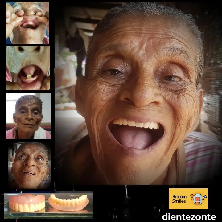 Bitcoin Smiles Story: Cecilia. Read her story on Bitcoin Smiles and help us to raise more funds for free dental care