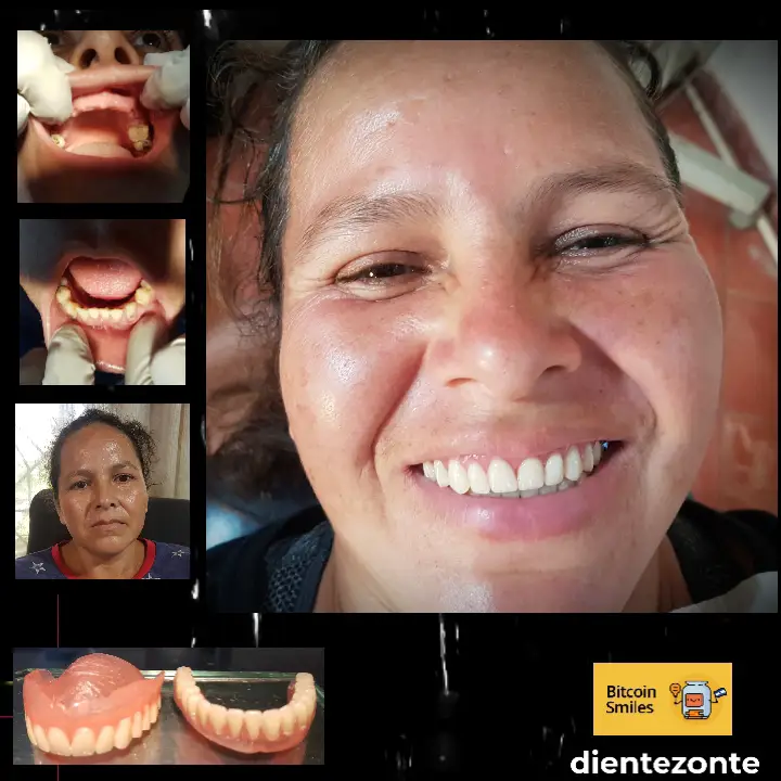 Bitcoin Smiles Story: Rosaura. Read her story on Bitcoin Smiles and help us to raise more funds for free dental care