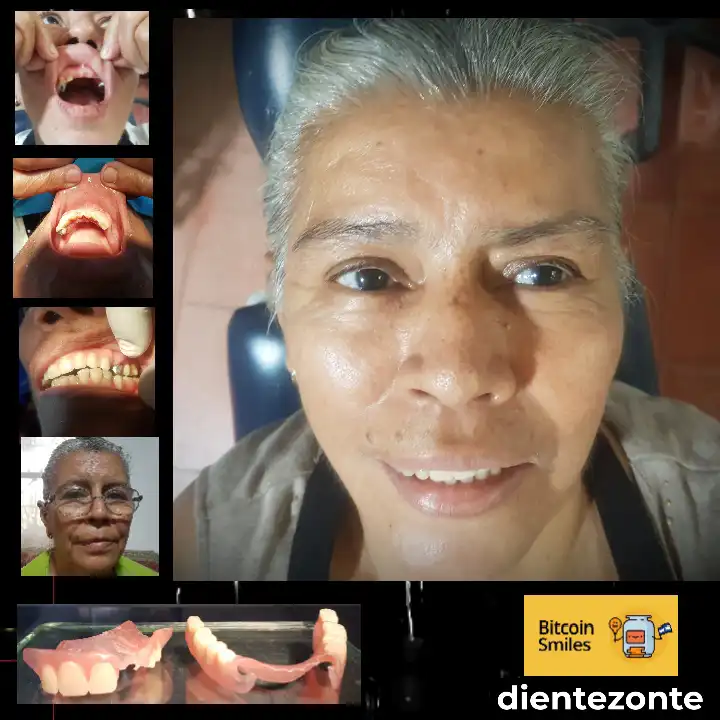 Bitcoin Smiles Story: Maria. Read her story on Bitcoin Smiles and help us to raise more funds for free dental care