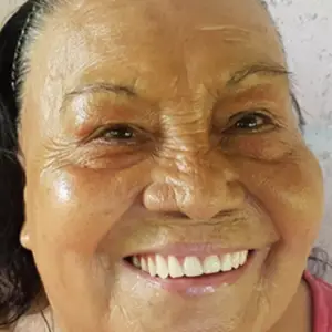 BitcoinSmiles recauda fondos y proporciona atención dental gratuita a Maura que vive en zonas rurales de El Salvador