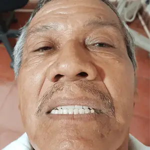 BitcoinSmiles raises funds and provides free dental care to Carlos living in rural areas of El Salvador